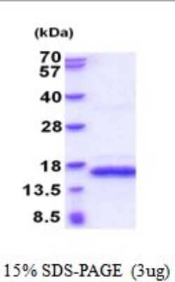 SDS-PAGE: Recombinant Human PDGF-B His Protein [NBP2-52012]