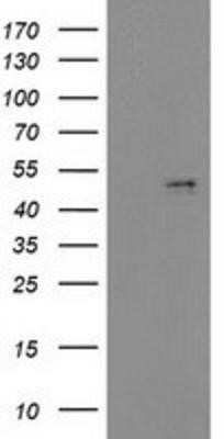 Western Blot: PDGF-D/SCDGFB Antibody (OTI1C1)Azide and BSA Free [NBP2-73305]