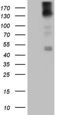 Western Blot: PDGFR alpha Antibody (OTI1C10) [NBP2-46357]