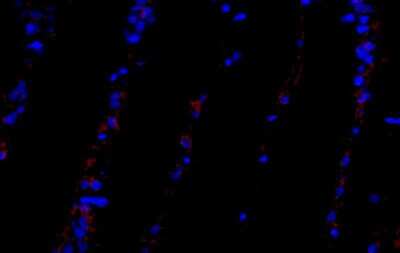 Immunocytochemistry/ Immunofluorescence: PDGFR alpha Antibody (8E12F2) - BSA Free [NBP2-52528]