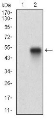 Western Blot: PDGFR alpha Antibody (8E12F2)BSA Free [NBP2-52528]