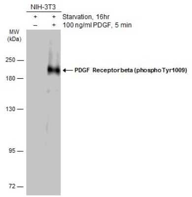 Western Blot: PDGF R beta [p Tyr1009] Antibody [NBP3-13249]