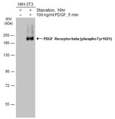 Western Blot: PDGF R beta [p Tyr1021] Antibody [NBP3-13238]