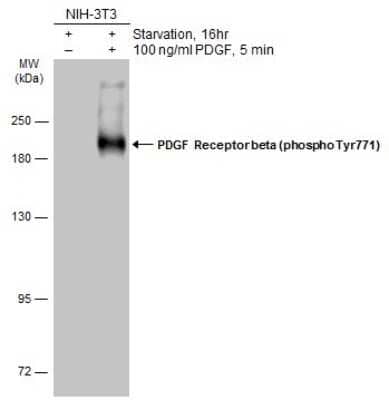 Western Blot: PDGF R beta [p Tyr771] Antibody [NBP3-13250]