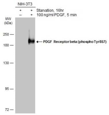 Western Blot: PDGF R beta [p Tyr857] Antibody [NBP3-13248]