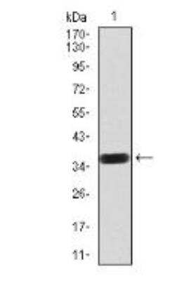 Western Blot: PDGF R beta Antibody (2G7B7)BSA Free [NBP2-52529]