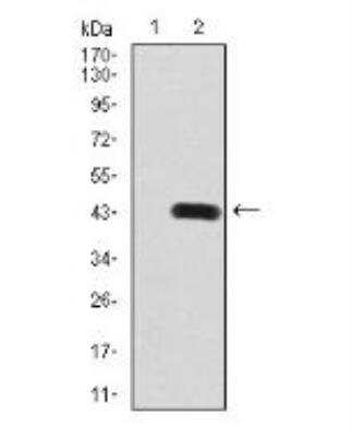 Western Blot: PDGF R beta Antibody (2G7B7)BSA Free [NBP2-52529]