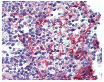 Immunohistochemistry-Paraffin: PDGF R beta Antibody (42G12) [NBP1-19191]