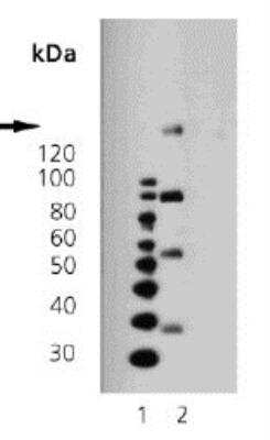 Western Blot: PDGF R beta Antibody (42G12) [NBP1-19191]