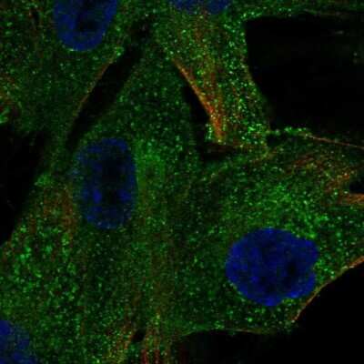 Immunocytochemistry/ Immunofluorescence: PDGF R beta Antibody [NBP1-88134]