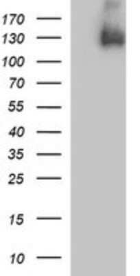 Western Blot: PDGF R beta Antibody (OTI1E8)Azide and BSA Free [NBP2-73304]