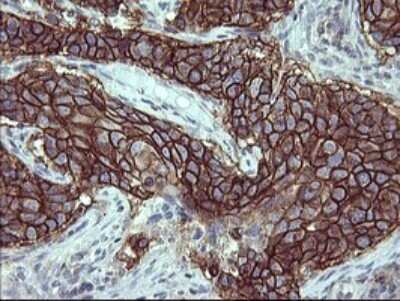 Immunohistochemistry: PDGF R beta Antibody (OTI1E8) [NBP2-46361]