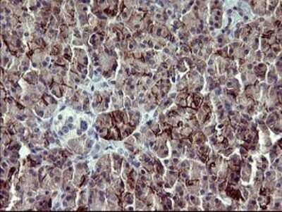 Immunohistochemistry: PDGF R beta Antibody (OTI1E8) [NBP2-46361]