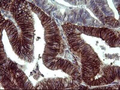 Immunohistochemistry: PDGF R beta Antibody (OTI1E8) [NBP2-46361]