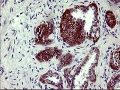 Immunohistochemistry: PDGF R beta Antibody (OTI1E8) [NBP2-46361]