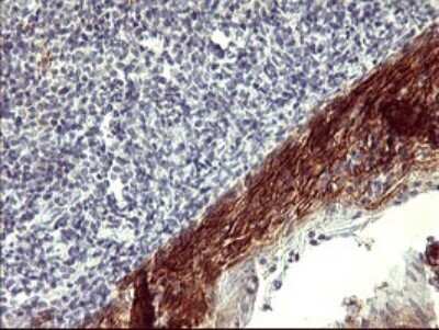 Immunohistochemistry: PDGF R beta Antibody (OTI1E8) [NBP2-46361]