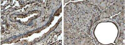 Immunohistochemistry-Paraffin: PDGF R beta Antibody (RM0005-4C54) - Azide and BSA Free [NB110-61021]