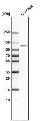 Western Blot: PDGF R beta Antibody [NBP1-88134]