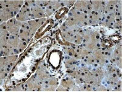 Immunohistochemistry-Paraffin: PDGFR alpha Antibody (RM0004-3G28) - Azide and BSA Free [NB110-61020]