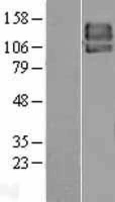 Western Blot: PDGF R beta Overexpression Lysate [NBL1-14239]