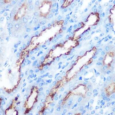 Immunohistochemistry-Paraffin: PDGFA Antibody - Azide and BSA Free [NBP3-05169]