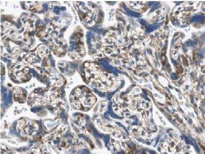 Immunohistochemistry-Paraffin: PDGFA Antibody (MM0013-6D35) - Azide and BSA Free [NB110-60979]
