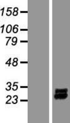 Western Blot: PDGFA Overexpression Lysate [NBP2-08092]