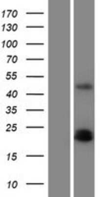 Western Blot: PDGFA Overexpression Lysate [NBP2-09939]