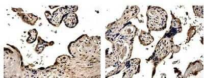 Immunohistochemistry-Paraffin: PDGF-B Antibody (MM0014-5F66) - Azide and BSA Free [NB110-60980]