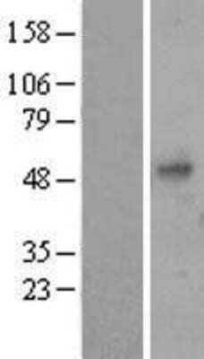 Western Blot: PDGF-B Overexpression Lysate [NBP2-04230]