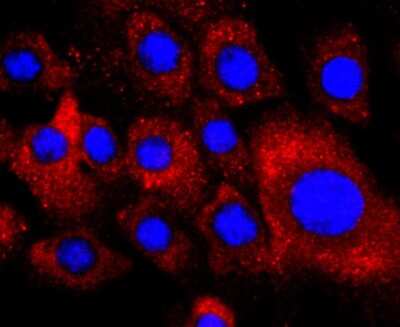 Immunocytochemistry/ Immunofluorescence: PDGFR alpha Antibody (JF104-6) [NBP2-67025]