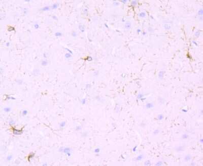 Immunohistochemistry-Paraffin: PDGFR alpha Antibody (JF104-6) [NBP2-67025]