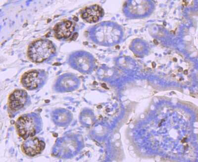 Immunohistochemistry-Paraffin: PDGFR alpha Antibody (JF104-6) [NBP2-67025]