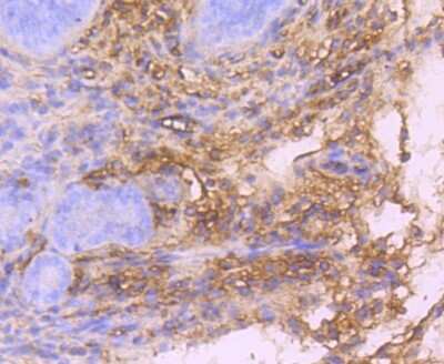 Immunohistochemistry-Paraffin: PDGFR alpha Antibody (JF104-6) [NBP2-67025]