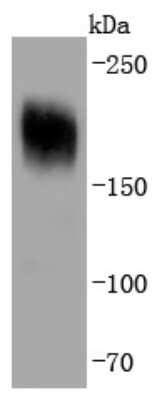 Western Blot: PDGFR alpha Antibody (JF104-6) [NBP2-67025]