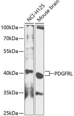 Western Blot: PDGFRL AntibodyBSA Free [NBP3-04738]