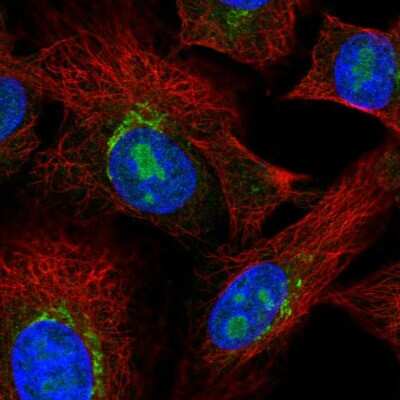 Immunocytochemistry/ Immunofluorescence: PDGFRL Antibody [NBP2-57012]