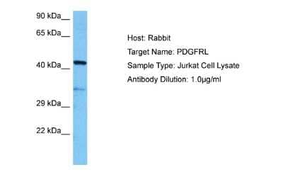 Western Blot: PDGFRL Antibody [NBP2-83377]