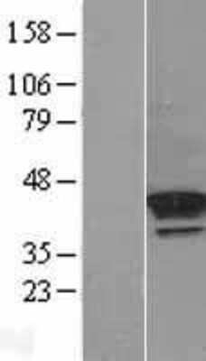 Western Blot: PDGFRL Overexpression Lysate [NBL1-14240]