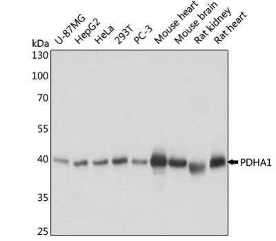 Western Blot: Pyruvate Dehydrogenase E1-alpha subunit Antibody [NBP2-95269]