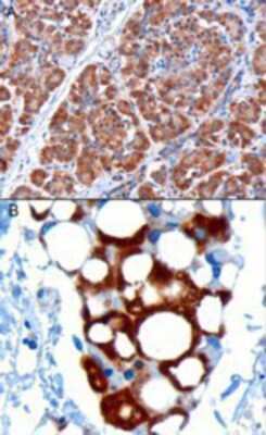 Immunohistochemistry: PDHX Antibody [NB100-1496]