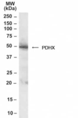 Western Blot: PDHX Antibody [NB100-1496]