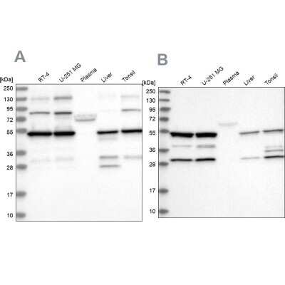 Western Blot: PDHX Antibody [NBP1-84079]