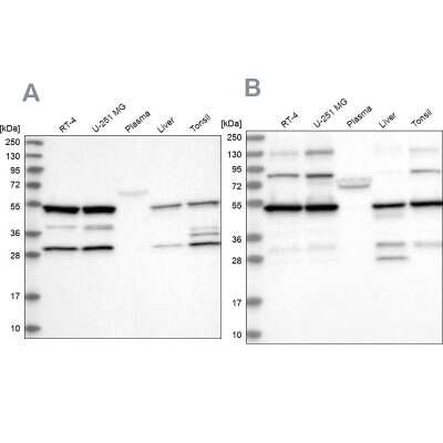 Western Blot: PDHX Antibody [NBP1-84080]