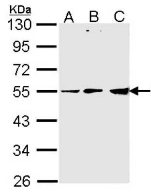 Western Blot: PDHX Antibody [NBP2-19749]