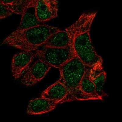 Immunocytochemistry/ Immunofluorescence: PDIA2 Antibody [NBP2-49086]