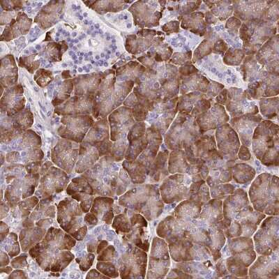 Immunohistochemistry: PDIA2 Antibody [NBP2-49086]