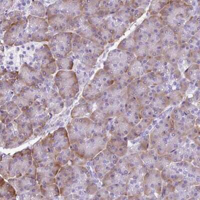 Immunohistochemistry-Paraffin: PDIA2 Antibody [NBP2-49015]