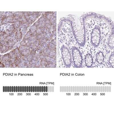 Immunohistochemistry-Paraffin: PDIA2 Antibody [NBP2-49015]