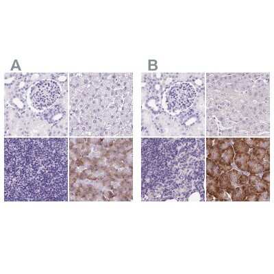 Immunohistochemistry-Paraffin: PDIA2 Antibody [NBP2-49015]